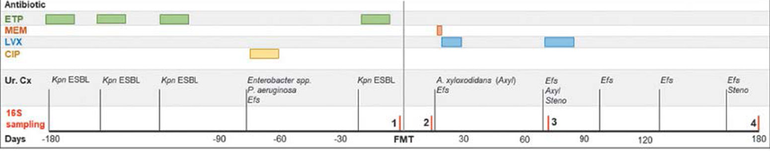 Timeline of clinical course in fecal transplant case study 